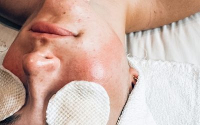 Valentine’s Day Advanced Aesthetics Skincare Special